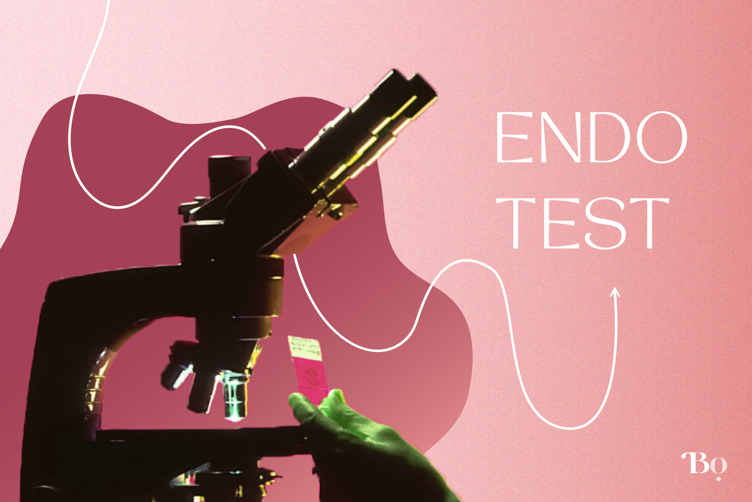 Endometrioseforschung, Endometriose diagnostizieren, Endometriosetest, Endometriosespeicheltest, Endometriose